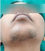 J Skin Stem Cell